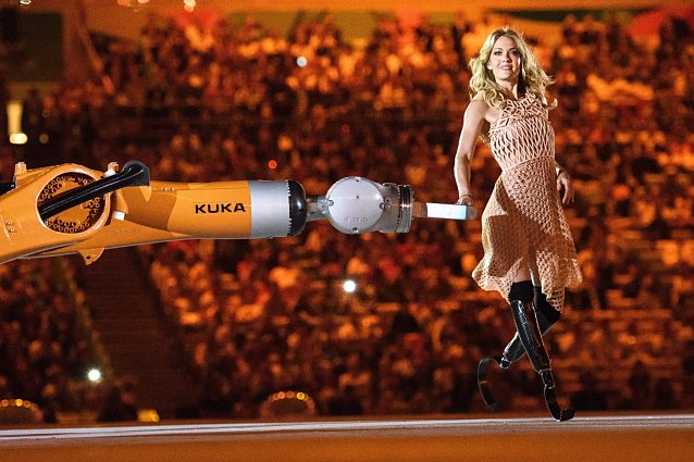 Bild: Amy Purdy