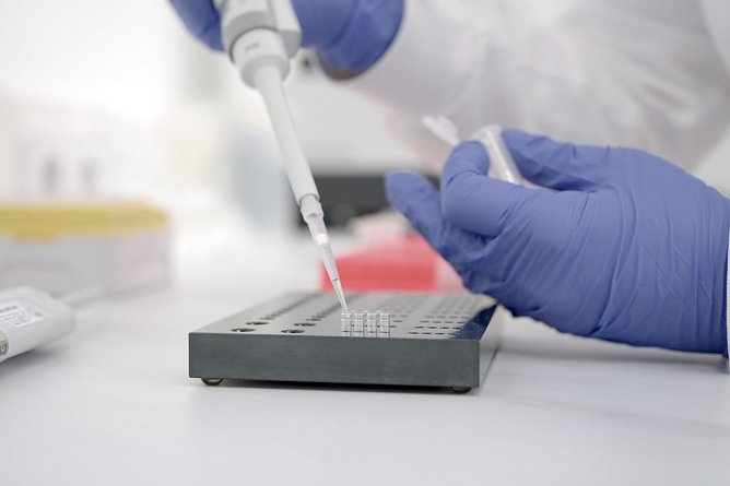 Unter dem Mikroskop fielen weder Federn, Borsten, Haare noch Horn auf (Foto: Stiftung Warentest)